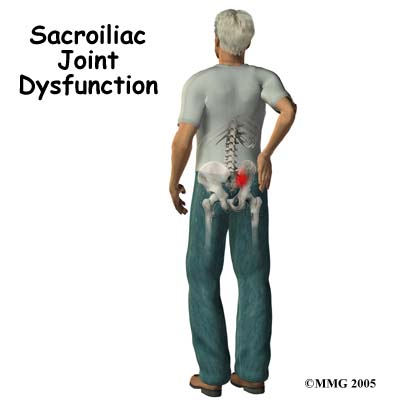 sacroiliac joint pain